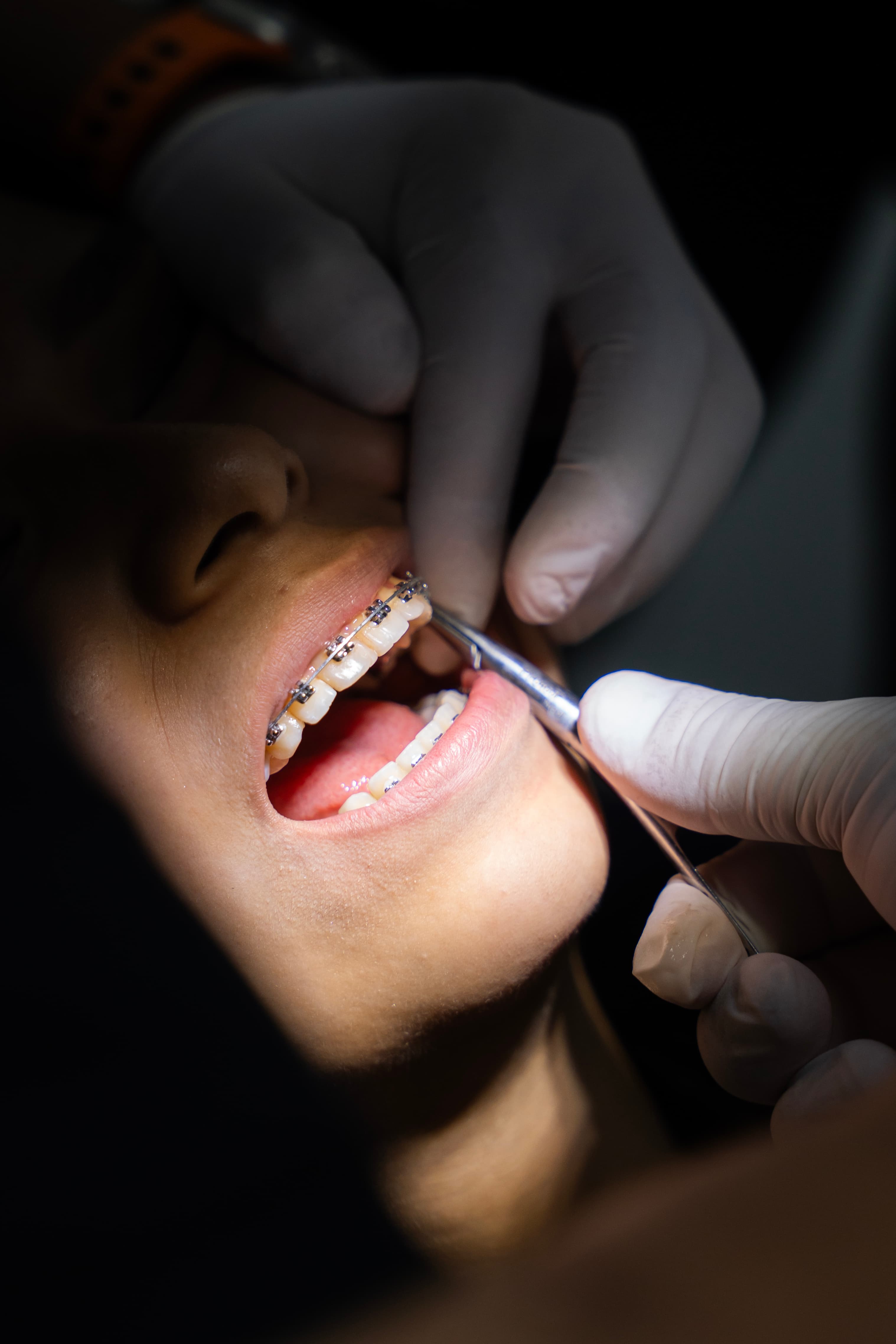 Tecnologia Escaneo Digital — Clínica Dental Odonto Smart Lima